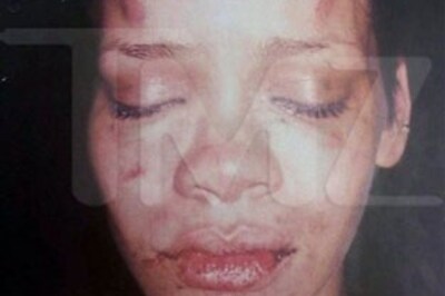 Singer Rihanna bruised, beaten by boyfriend
