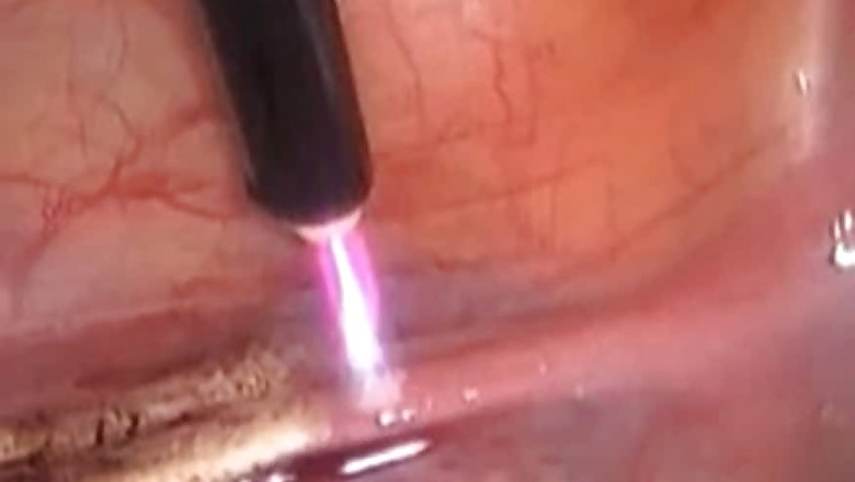 'Arrogant' UK Surgeon Burned Initials Onto Patients' Livers