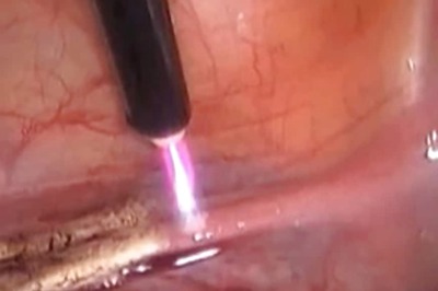 'Arrogant' UK Surgeon Burned Initials Onto Patients' Livers