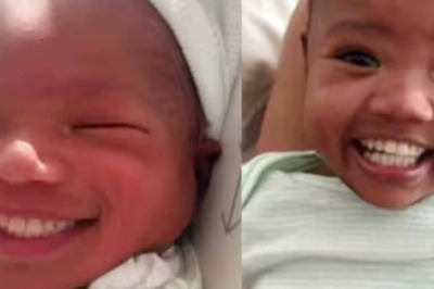 Woman Shares Clip Of Her Baby Born With Teeth, Raises Awareness On This Medical Condition