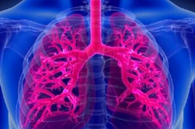 Deciphering Lung Cancer: The Power of Early Detection for Better Outcomes
