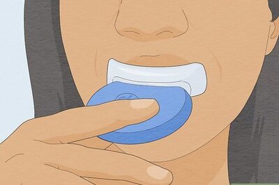 How to Whiten Your Teeth Without Spending a Lot of Money