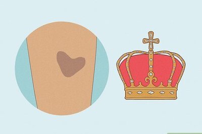 Everything You Need to Know About Royal Birthmarks