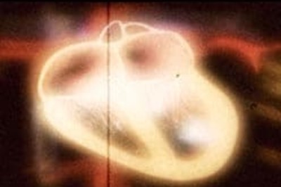 Painkillers increase heart failure risk