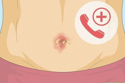 How to Treat an Infection in Your Belly Button