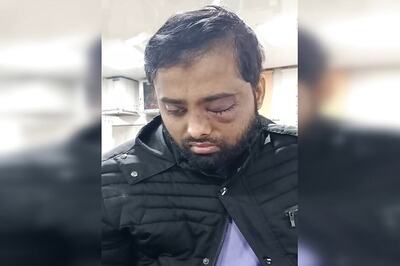'Might Lose Vision in Other Eye as Well': Jamia Student, Beaten by Police, Rues Lack of Support