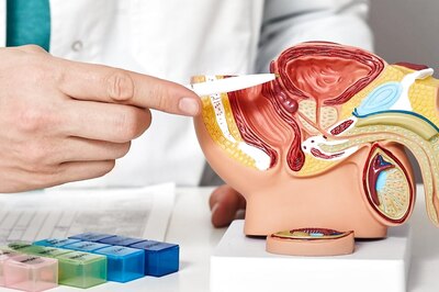 Prostate Cancer Can Be Fatal For Men; Here Are 5 Ways To Treat It