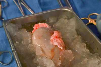 US Doctors Transplant Gene-Edited Pig Kidney In Living Person In A Trailblazing First