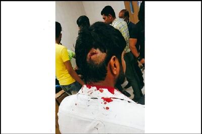 NSUI Gen Secy, Others Injured in Clashes With ABVP During Protest Over JNU Violence in Gujarat