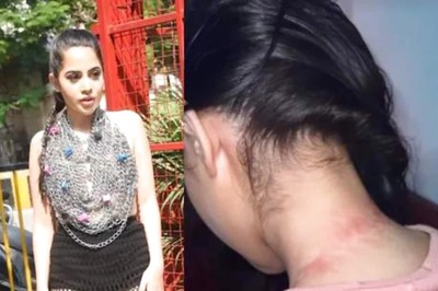Urfi Javed’s Fashion Turns Into a Nightmare, Causes Injury; Know How