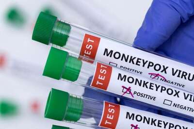 Maha: Nine Out of Ten Suspected Monkeypox Patients Test Negative, One Result Awaited