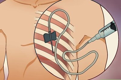 How to Treat Lung Cancer