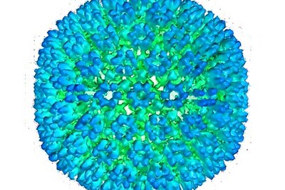 Study: Stronger Evidence Linking Virus To Multiple Sclerosis