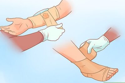 How to Treat a Dislocation