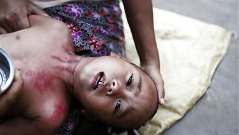 Malaria epidemic kills 51 in Tripura